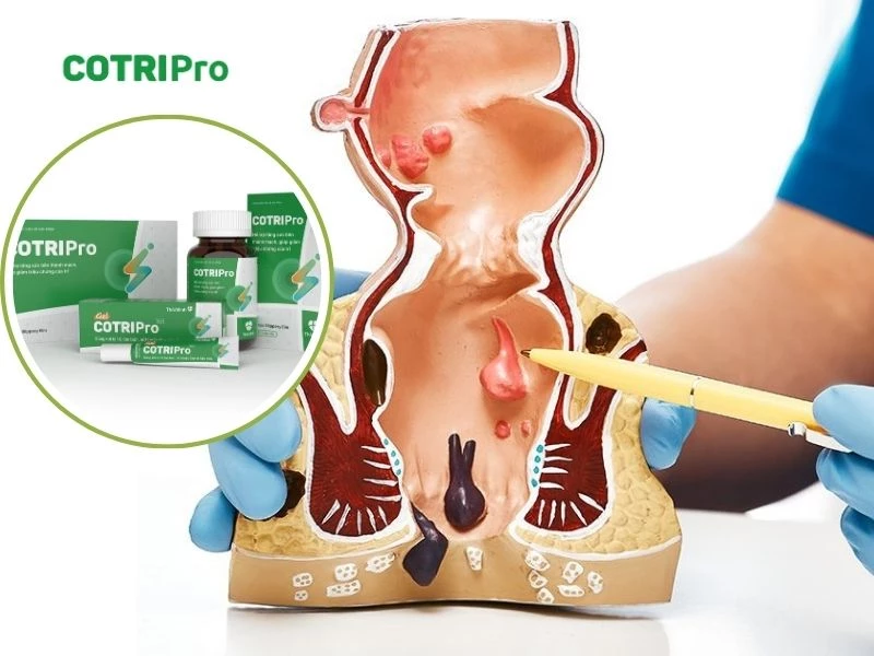 Combo COTRIPro và gel làm teo búi trĩ