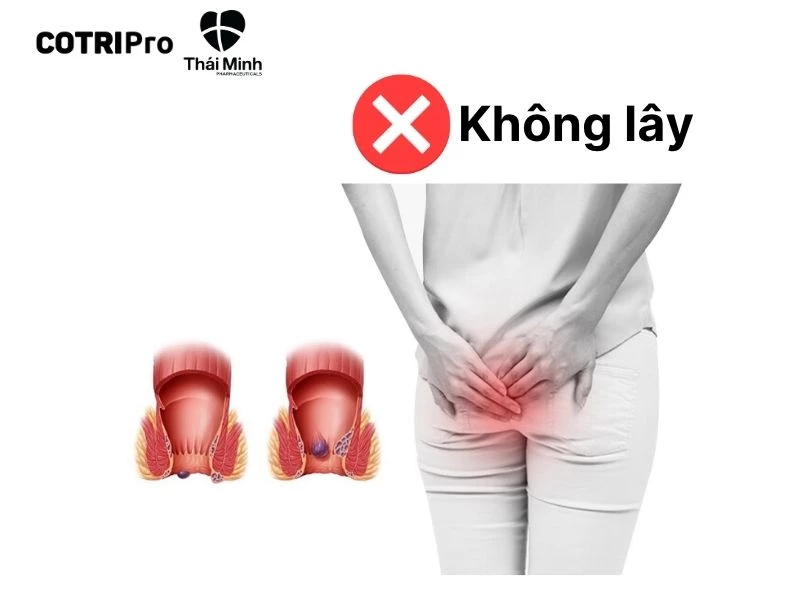 Bệnh trĩ không lây lan