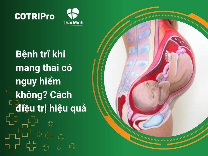 Bệnh trĩ khi mang thai có nguy hiểm không? Cách điều trị hiệu quả