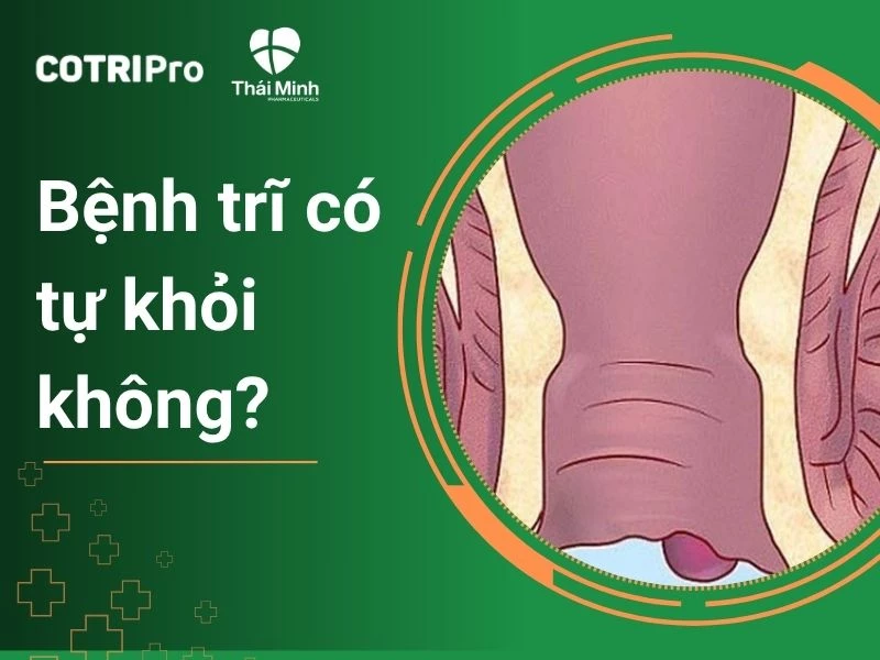 Giải đáp: Bệnh trĩ có tự khỏi không? Tự khỏi như thế nào