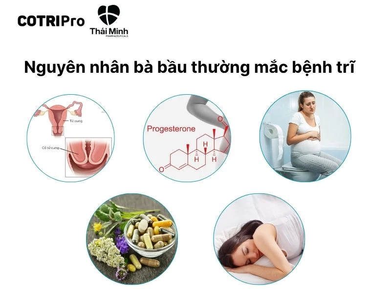 Bà bầu mắc trĩ do nguyên nhân nào