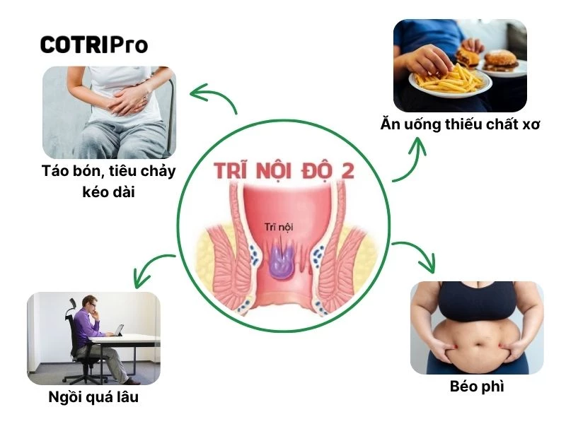 Nguyên nhân bệnh trĩ nội độ 2