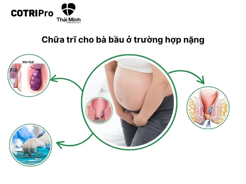 Phẫu thuật không xâm lấn trị trĩ