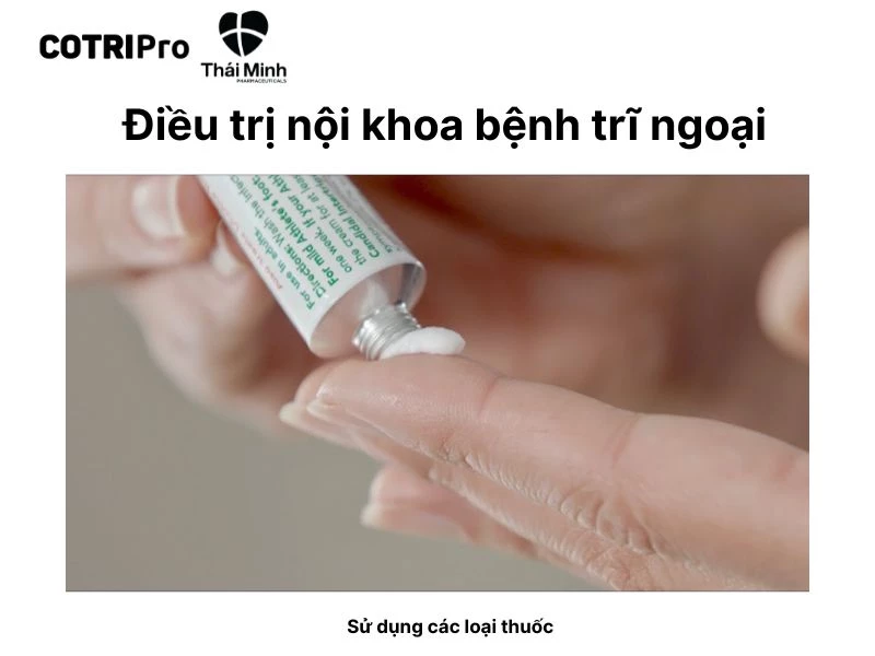 Điều trị nội khoa trị trĩ ngoại