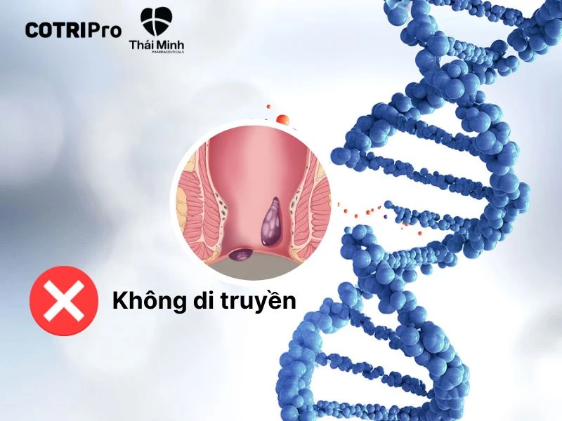 Trĩ không thể di truyền