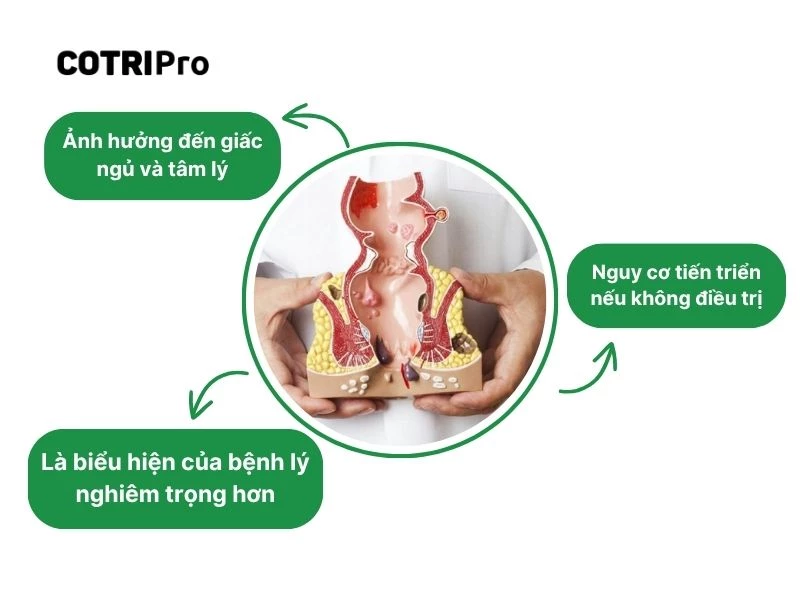 Bệnh trĩ độ 2 khá nguy hiểm