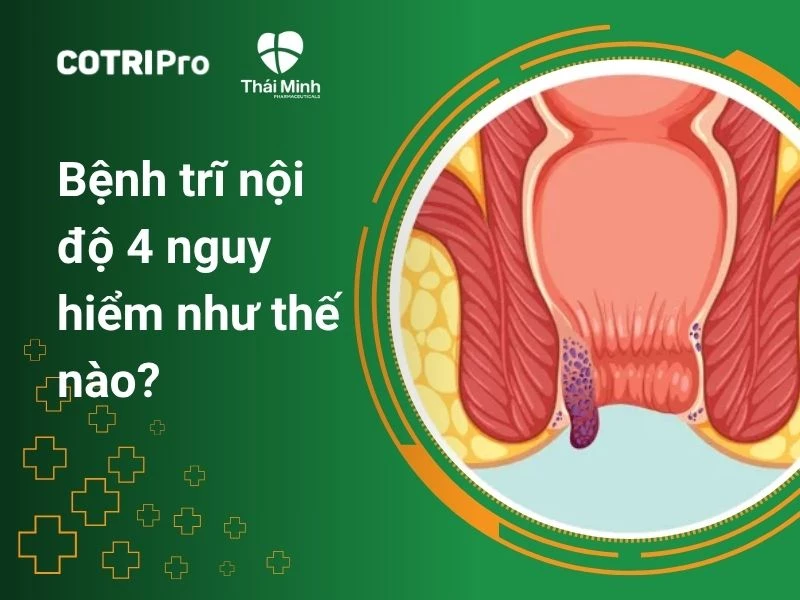 Bệnh trĩ nội độ 4 nguy hiểm như thế nào? Cách điều trị hiệu quả