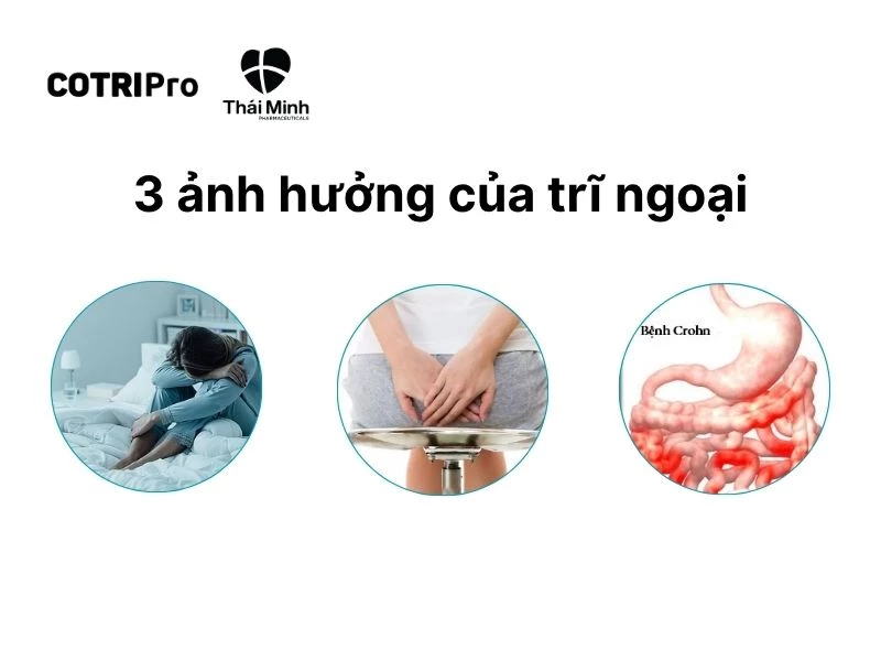 Trĩ ngoại gây nguy hiểm đến cuộc sống