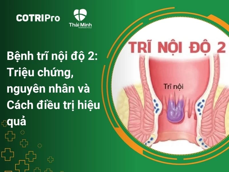 Bệnh trĩ nội độ 2: Triệu chứng, nguyên nhân và Cách điều trị hiệu quả