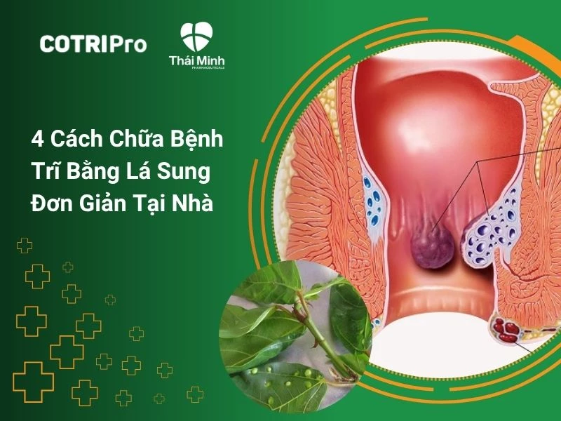 4 cách chữa bệnh trĩ bằng lá sung đơn giản tại nhà