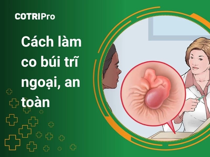 4 Cách làm co búi trĩ ngoại tại nhà an toàn, teo xẹp búi trĩ nhanh