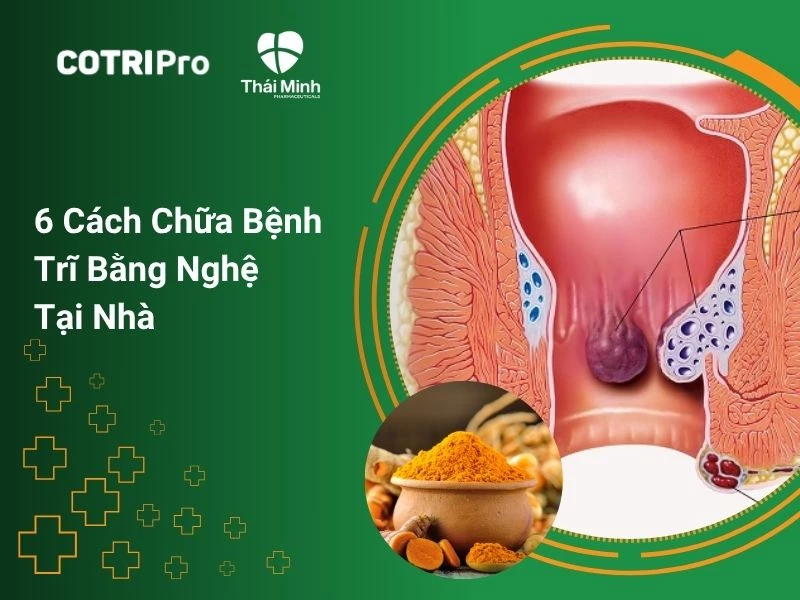 5 Cách Chữa Bệnh Trĩ Bằng Nghệ Tại Nhà