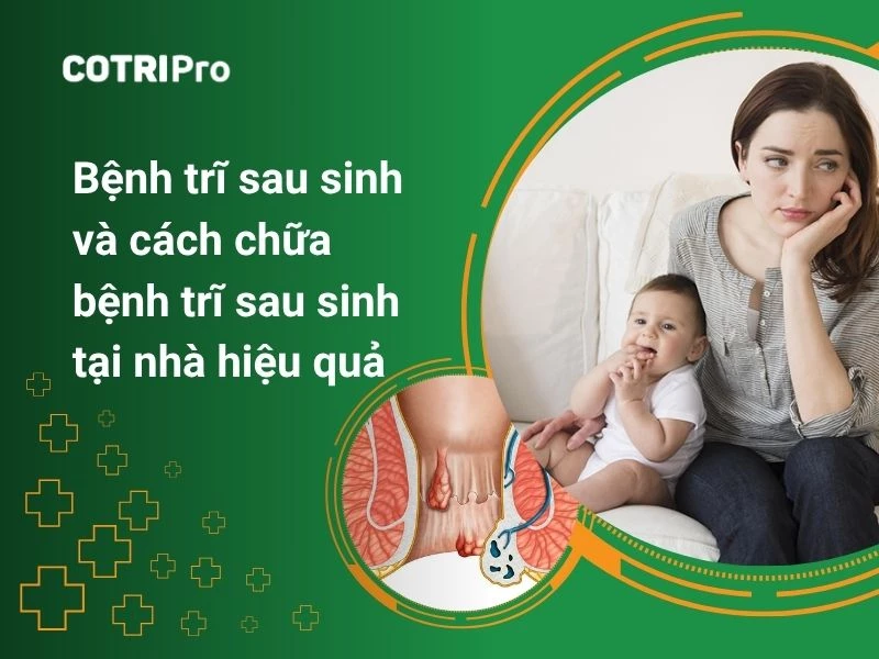 Cách chữa bệnh trĩ sau sinh hiệu quả, an toàn