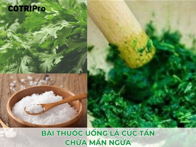 bài thuốc chữa mẫn ngứa