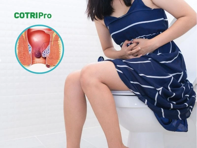 Tổng quan về bệnh trĩ sau sinh