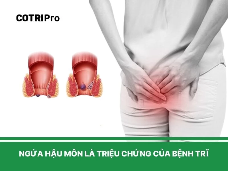 Dấu hiệu nhận biết trĩ ngứa hậu môn