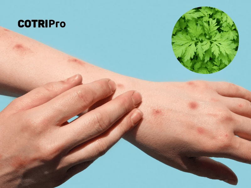 Ngải cứu trị ngứa, mụn nhọt, mề đay