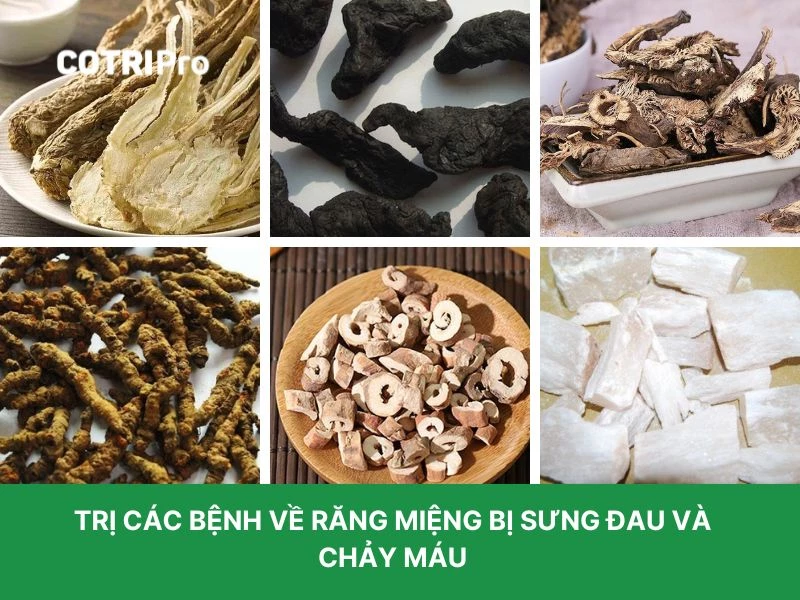Đương quy trị đau răng