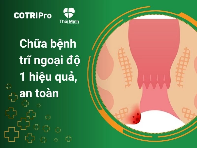 Cách điều trị trĩ ngoại cấp độ 1 tại nhà, hiệu quả, an toàn