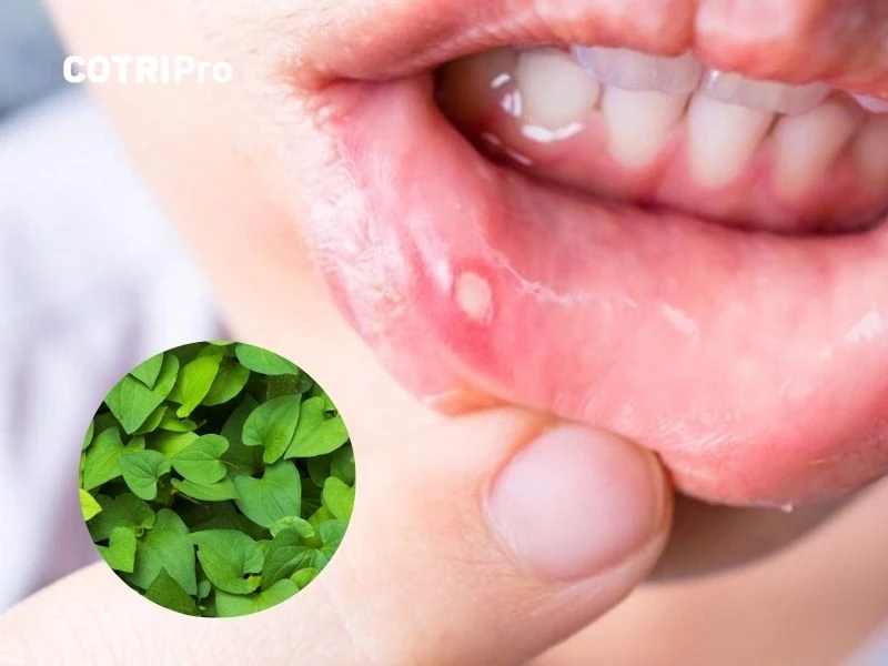 Diếp cá trị nhiệt miệng