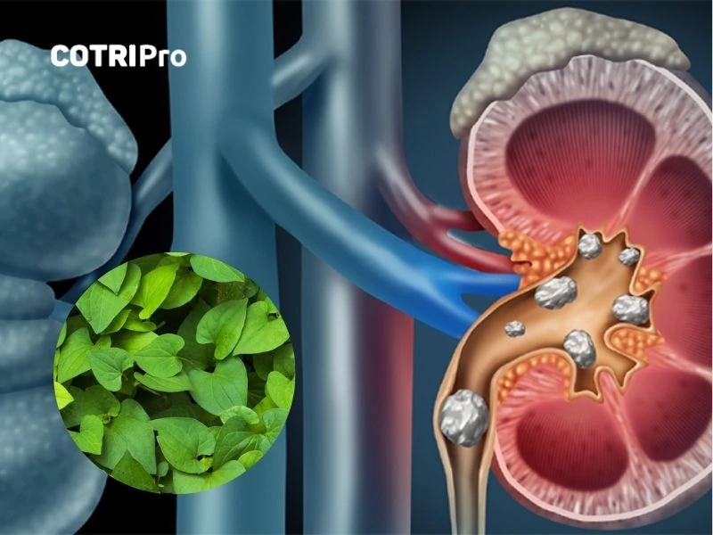 Diếp cá trị sỏi thận