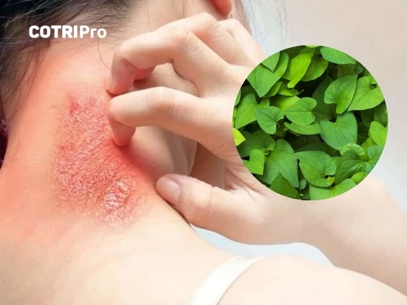 Rau diếp cá trị viêm da