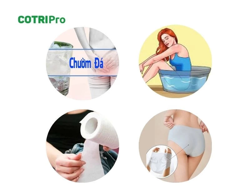 Chăm sóc hậu môn, ngừa chảy máu trĩ