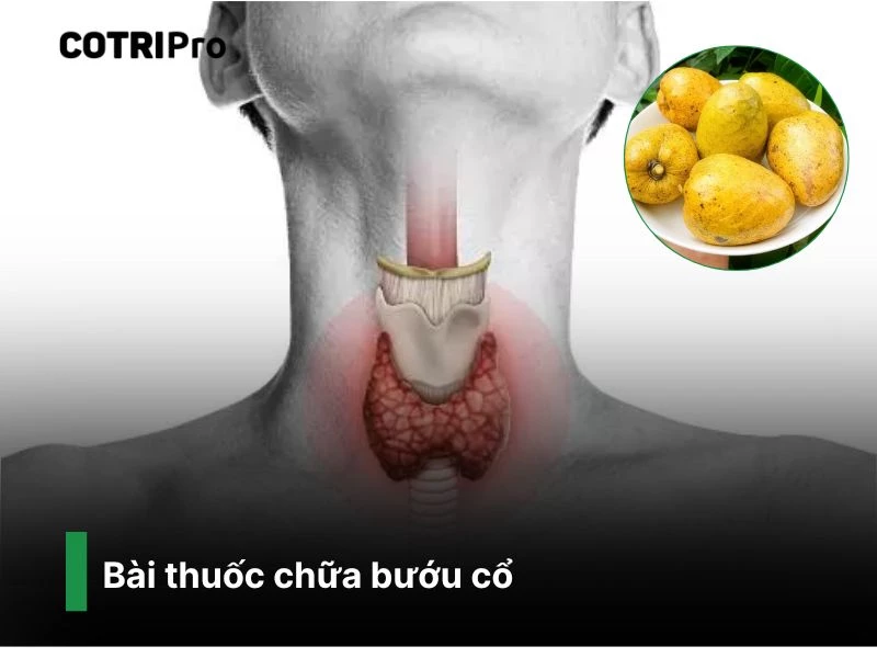 Chữa bướu cổ với quả bình bát