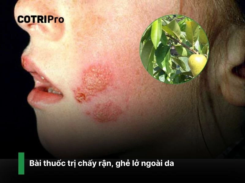 Lá và hạt cây bình bát có tính sát khuẩn mạnh