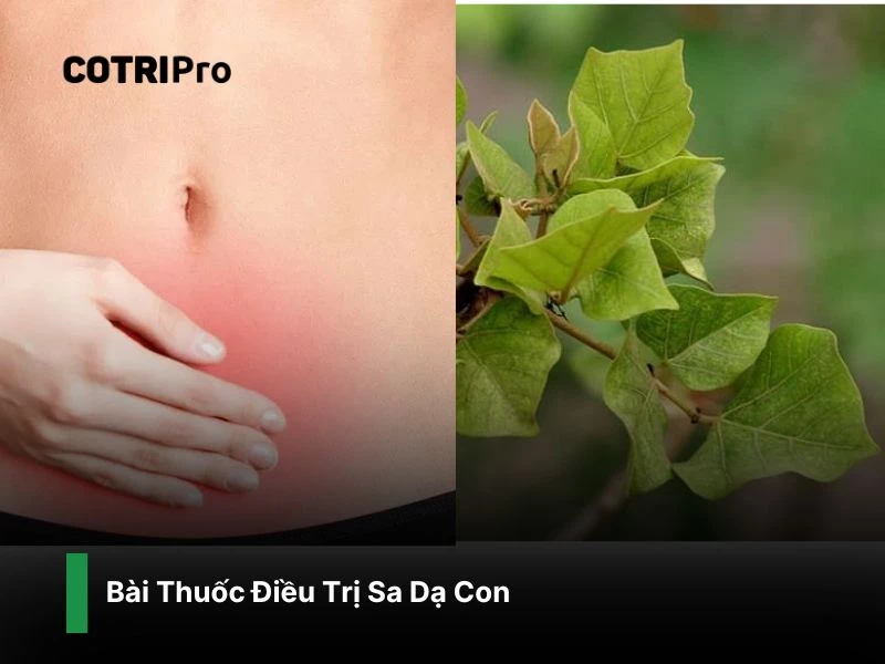 Chữa sa dạ con với bài thuốc cây vông