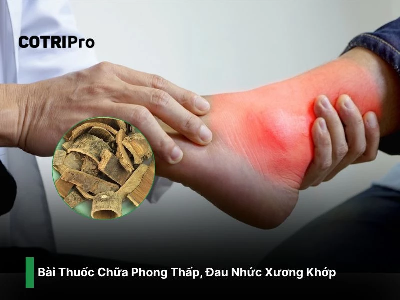 Điều trị đau nhức xương khớp với cây vông