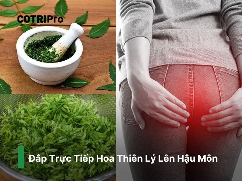 Đắp hoa thiên lý lên hậu môn ngừa trĩ
