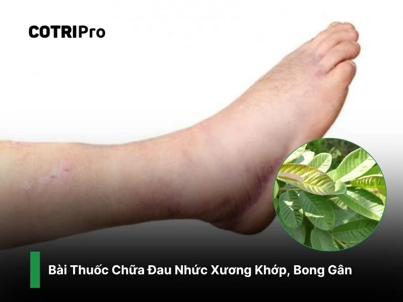 Chữa đau nhức xương khớp với lá ổi