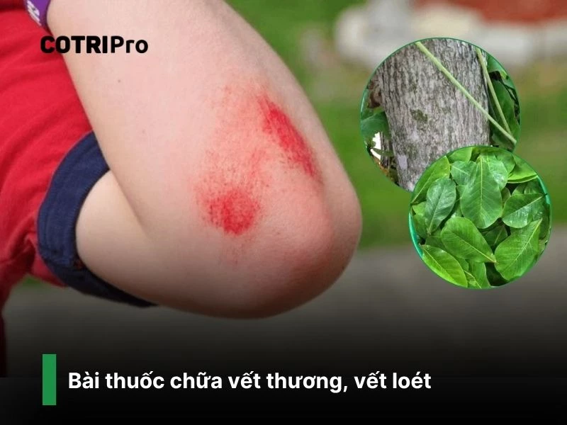 Chữa lành vết thương, viêm da với lá bàng