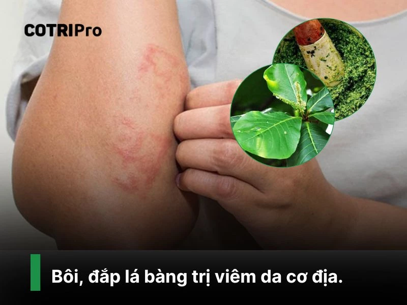 Chữa viêm da với lá bàng