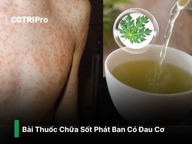 Trị phát ban giảm sốt với lá đu đủ