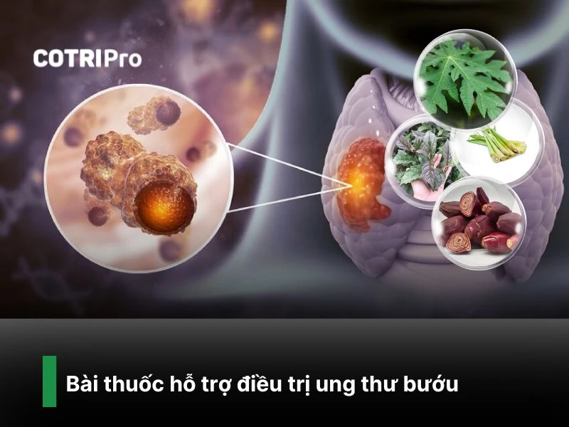 Điều trị ung bướu với lá đu đủ