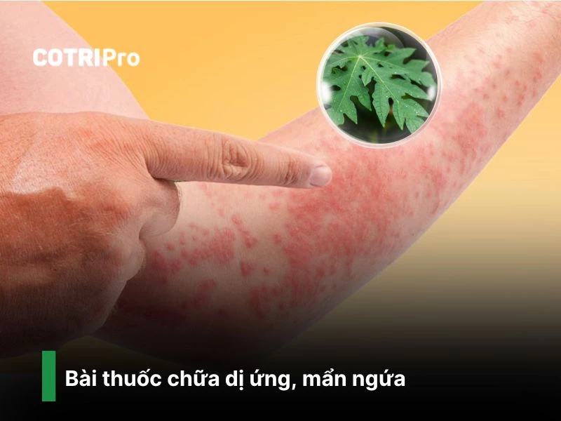 Chữa mẫn cảm dị ứng với lá đu đủ