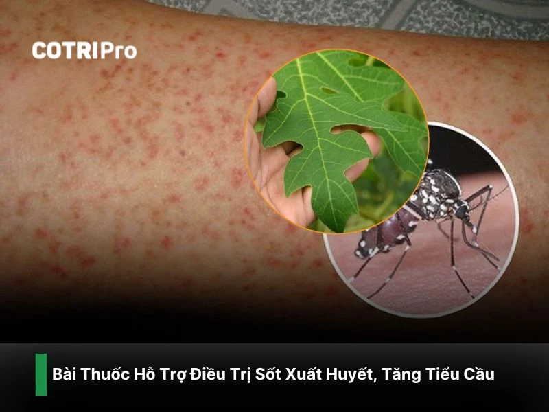 Trị xuất huyết với lá đu đủ