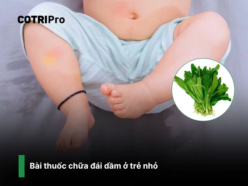 Bài thuốc trị đái dầm ở trẻ em với ngò gai