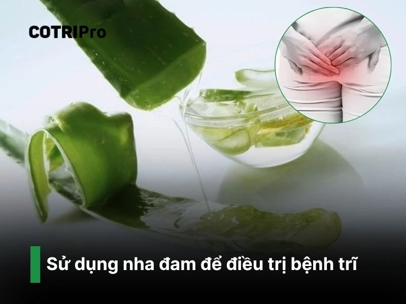 Thoa gel nha đam trị trĩ