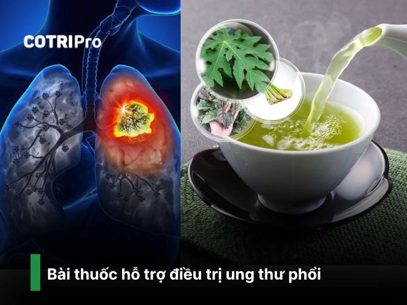 Điều trị ung thư phổi với trà từ lá đu đủ