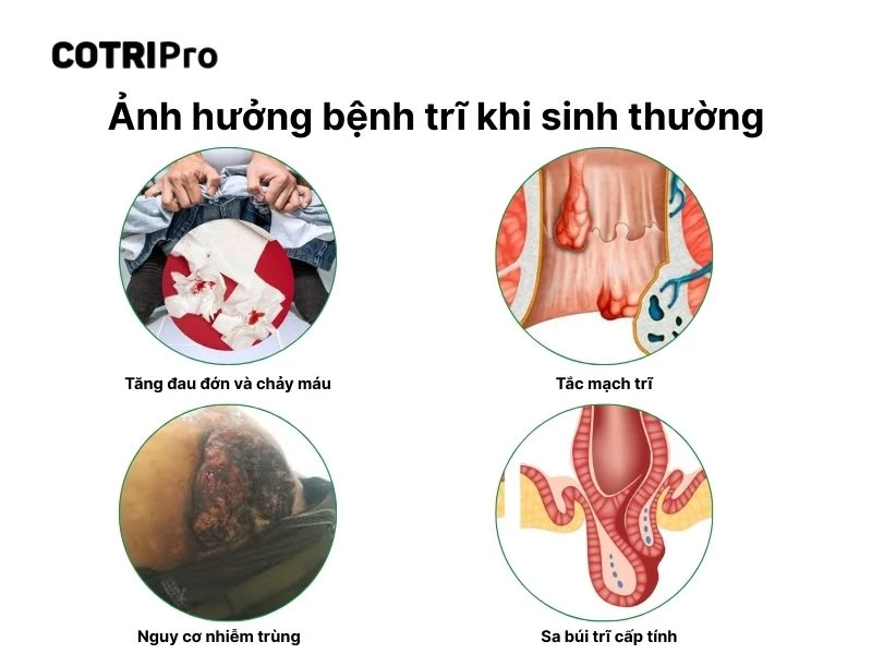 Nguy cơ trĩ sinh thường