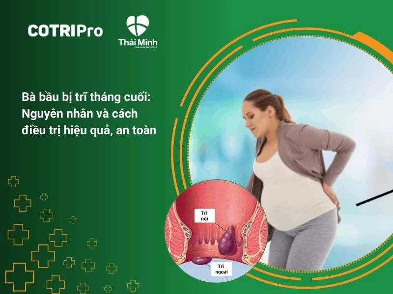 Bà bầu bị trĩ tháng cuối: Nguyên nhân và cách điều trị hiệu quả, an toàn