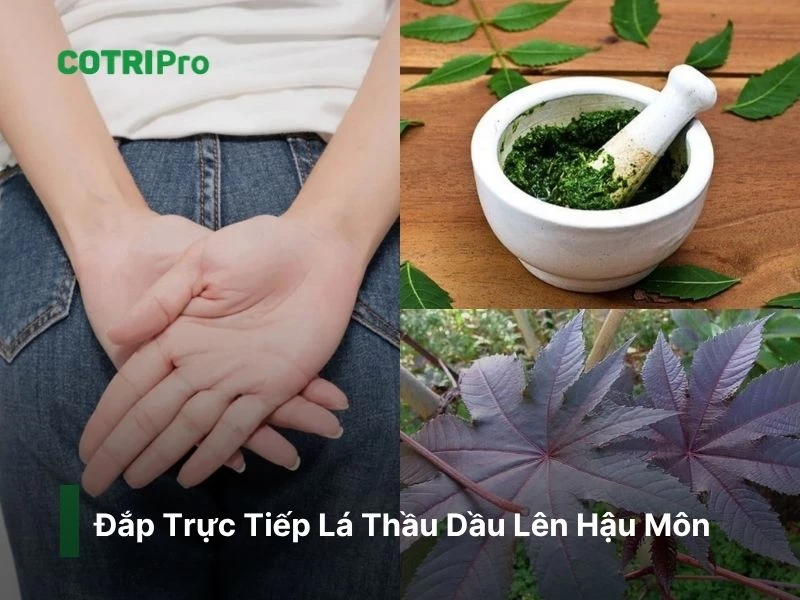 Đắp trực tiếp lá thầu dầu lên búi trĩ