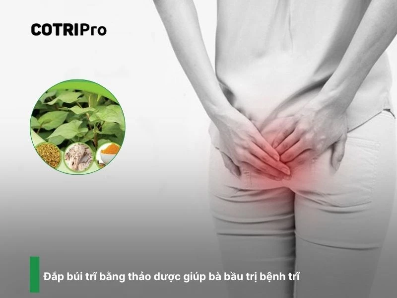 Đắp búi trĩ với thảo dược chống viêm nhiễm
