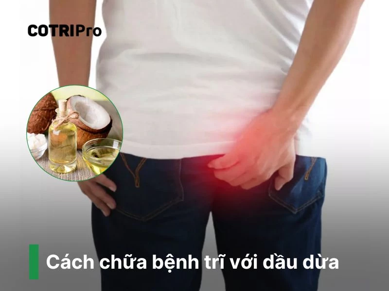 Dầu dừa chữa bệnh trĩ