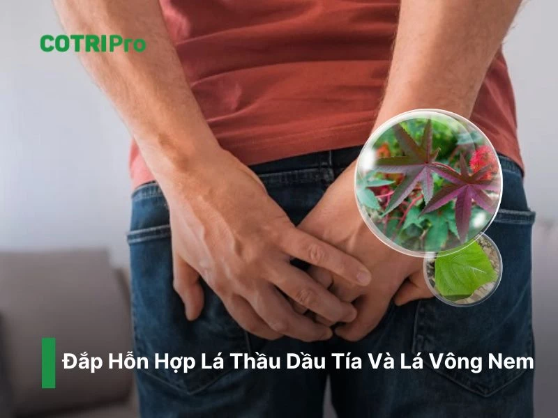 Đắp thầu dầu và lá vông nem lên búi trĩ
