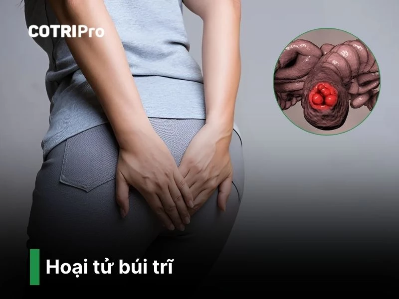 Hoại tử búi trĩ nguy hiểm