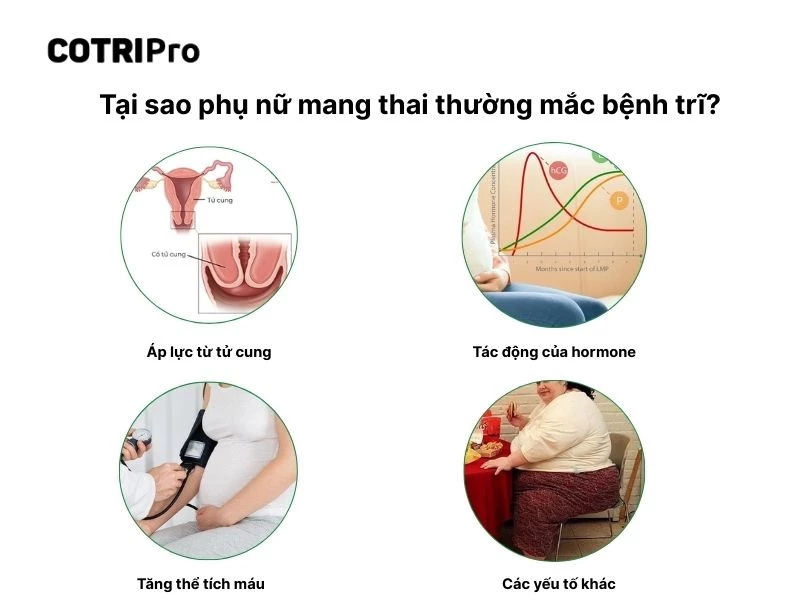 Áp lực tử cung khiến bà bầu dễ bị trĩ